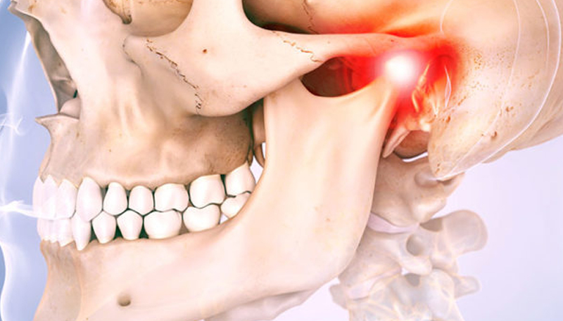 Articulacion Temporomandibular