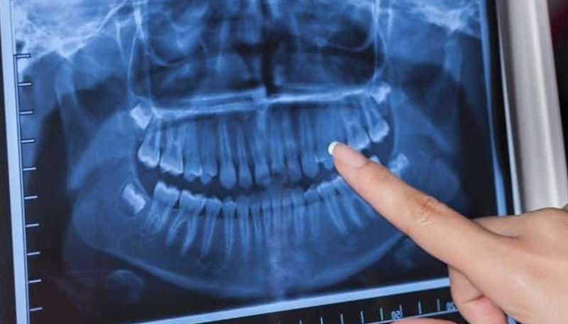 Radiologia Dental